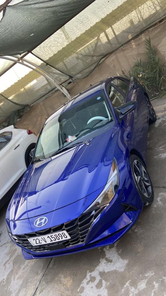 النترا 2023
2000 دوش 

رقم اربيل تريد وكاله تريد تحويل 

واتساب او اتصال 

***********
