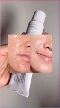 بشرة صافية • بدون حبوب • بدون اسمرار