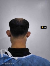 اذن بارزة • دكتور محمود احمد • الشطرة ذي قار