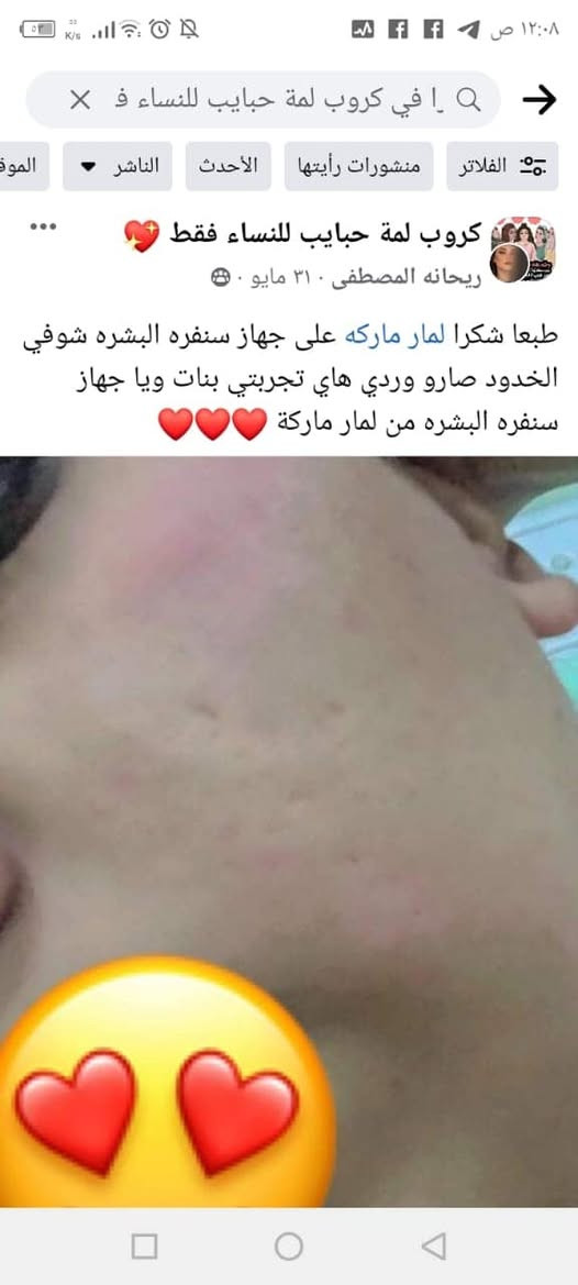تجارب الزبائن بالمنتجات العدنه وبعد اكو أكثر تجارب بس هذني كبالي صارن  الحمدلله على المصداقيه كله بفضل رب العالمين 🙏 شكرا لكل وحده انطتنه الثقه 💪
مستمرين وياكم بكلشي مفيد واصلي بعون الله


**إذا كنت صاحب هذا الإعلان وتريد حذفه لأي سبب، رجاءا أرسل رسالة إلى الدعم الفني**