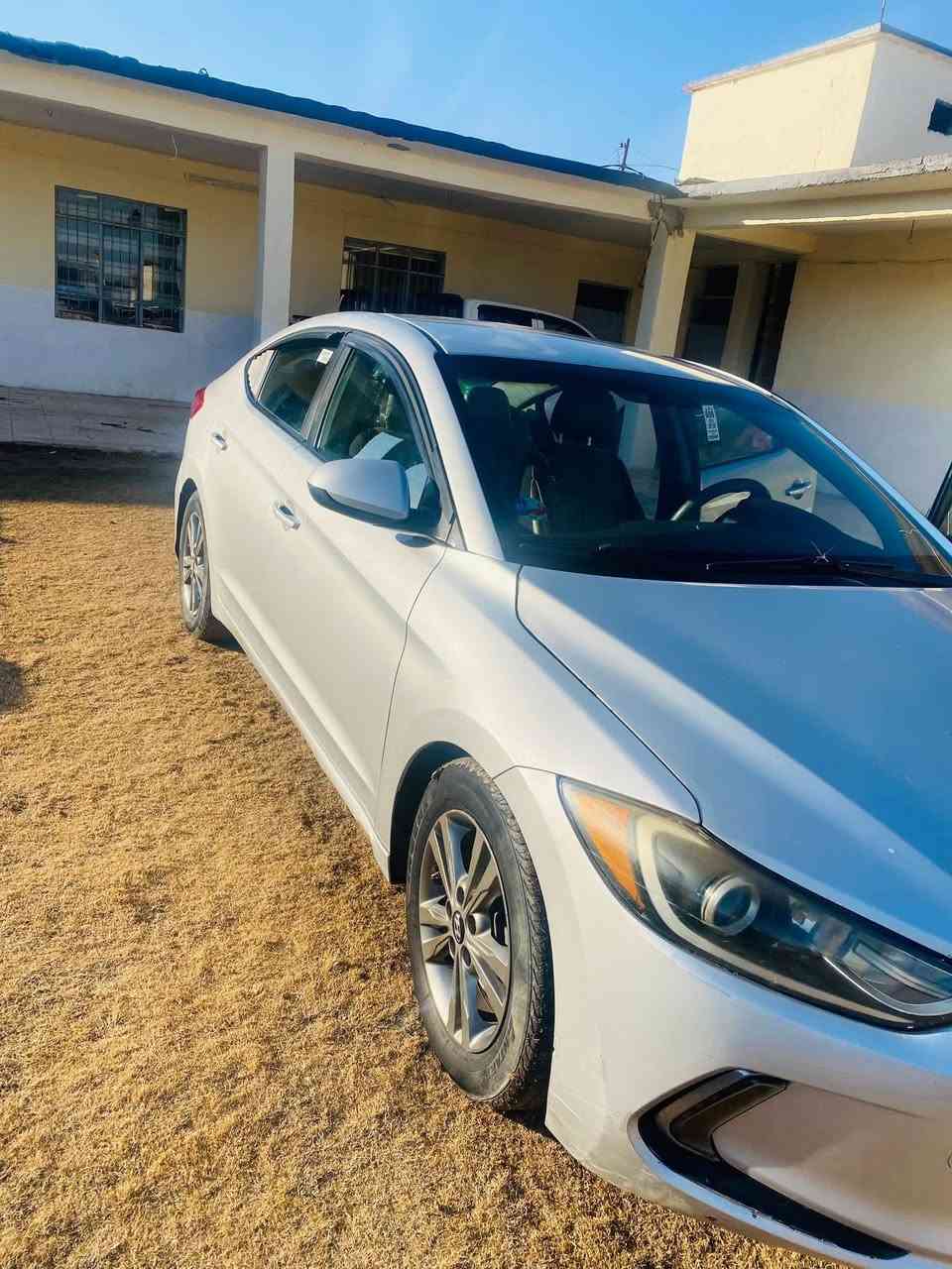 سلام عليكم النتره البيع موديل 18 ضرر بونيد السعر 122   استفسار ***********
