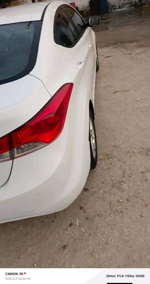 سلام عليكم سياره النتره 2014 سياره كصت جنطه سياره جاهزه و حلوه سياره فول مواصفات بصمه مكينه كير حداده جاهزه  السعر 50 وبيه مجال أو مراوس اب بنكو فقط ***********
