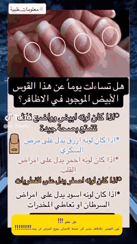 ❤❤❤💚💚هل تعلم!!لون القوس في الاظافر دلالة على صحتك!!!
👨🏻‍🦰🧓🏻👩🏻‍🦰
مجمع نور الزهراء الطبي التخصصي#
📍-بغداد -المشتل - منتصف شارع المطبك - مقابل مصور طرابلس -مجاو  صيدلية نور عبد الله الزلزلي 📍
                                      ➖️➖️➖️
للحجز والاستفسار يمكن الاتصال على الرقم
☎️ *********** ☎️
او مراسلة الصفحة 📨📨
https://www.facebook.com/noorphrmacy
#طب#جراحة_العظام_والكسور#"طب_وجراحة _العيون_الكلى_والقلبيية#طب النسائية_والتوليد#امراض#تمريض#مختبر
#السكري#انخفاض_مرض_السكري#التصرف_الصحيح_فى_حالة_انخفاض _السكر#الاظافر#لون_قوس_الاظافر#التشخيص#معلومة_طبية
@الجميع@الاشارة@المتابعين@@بغداد@المشتل@البلديات@الامين
