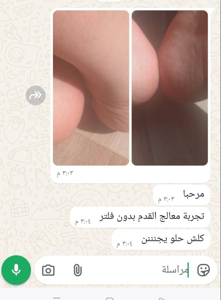 معالج القدم الأصلي ✨ 3 قطع ب14 وتوصيل مجاني وحجم كبير يكفي اكثر من شهر والله ع مفعوله يسوه اكثر 
مو كالوس ولا كريم يقشّر ويخلي الجلد رقيق ويتعب القدم 👎
هذا معالج علاجي مليان زيوت عشبية وزبدات وكريمات مغذّية
يرمّم الجلد من الداخل ويرجّع له صحته وقوّته 👣
💧 بيه يوريا ترطّب أعماق الجلد
من أول استعمال الفرق يبين
تشقق؟ خشونة؟ جفاف؟ يختفون
👶 القدم تصير قدم بيبي
لون وردي خفيف وطبيعي
مو بس من جوّه… حتى من فوگ ينطي تفتيح ونظافة ولمعة ✨
حتى الأظافر تصير ورديّة وتلمع
عبالك صبغ أظافر ✨ وبدون ما يمنع الوضوء 😂
🔥 أتحدّى وحدة جربته وما شافت فرق من أول مرة
جربيه وراح تعرفين شنو يعني علاج مو بس ترطيب


**إذا كنت صاحب هذا الإعلان وتريد حذفه لأي سبب، رجاءا أرسل رسالة إلى الدعم الفني**