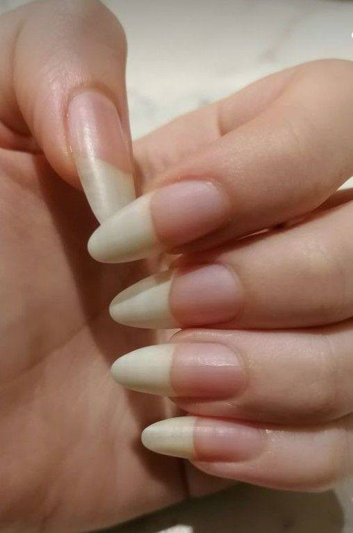 🎀عرض خاص🎀 عرض الكولاجين الامريكي🇺🇸💯
للبشرة والجسم والشعر والاضافر والعضام والغضاريف ويقلل تجاعيد وينطي نضارة يتكون من شراب الكولاجين + حبوب الكولاجين 

1♦️تواصل خاص 
🚘 يوجد خدمة توصيل لجميع محافظات العراق ٤ الاف 🚘


**إذا كنت صاحب هذا الإعلان وتريد حذفه لأي سبب، رجاءا أرسل رسالة إلى الدعم الفني**