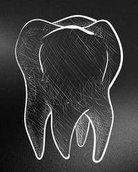 اي احد يحتاج قلع اسنان او حشوات او تعويضات سنية للي فاقد اسنان مجاناا ...