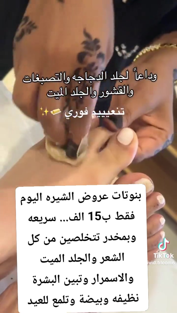 بنات إذا بعدكم ما مجربين الشيرة الصح قبل العيد… ففاتكم فرق يبين من أول مرة 🤍
الشيرة مو بس إزالة شعر وبس 👀
هي حرفيًا تخلي الجسم:
• أنعم بشكل واضح
• يلمع ويصير شكله أنظف
• تساعد تقلل الشعر مع الاستمرار
• تشيل الجلد الميت وتعطي نضارة ✨
• تخلي المكياج واللوشن والعطور يثبتون أحلى على الجسم
• وتعطي إحساس نظافة وانتعاش يفرق بكل شي 🤍
ويا الاستمرار؟
تلاحظين البشرة أصفى وأنعم والشعر يطلع أخف 💅🏻
قبل العيد دللي نفسج شوي…
لأن الإحساس بالبشرة النظيفة والناعمة يغيّر المود كله 🌸


**إذا كنت صاحب هذا الإعلان وتريد حذفه لأي سبب، رجاءا أرسل رسالة إلى الدعم الفني**