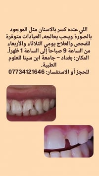✨العلاج مجاني 🦷 فحص الاسنان_حشوات ضوئية _تنظيف الاسنان_قلع الاسنان 📍 ب...