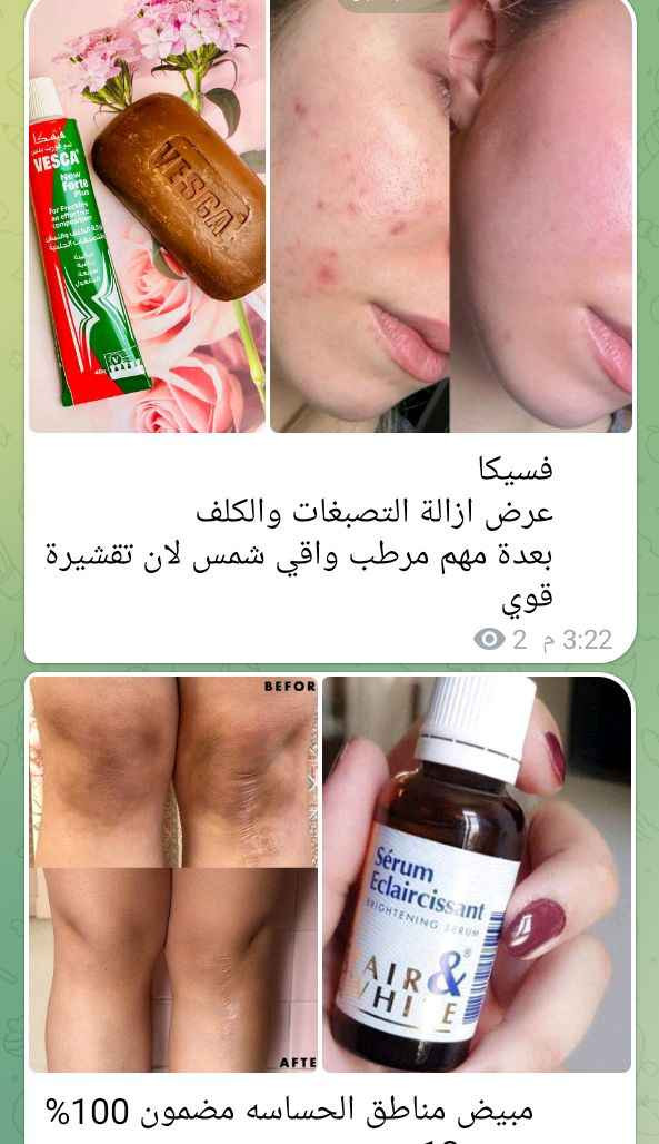 كوزمتك الجوهره الشطره, ذي قار


**إذا كنت صاحب هذا الإعلان وتريد حذفه لأي سبب، رجاءا أرسل رسالة إلى الدعم الفني**