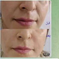 سيروم جل • مضاد تجاعيد • يشد البشرة