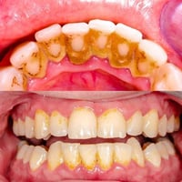 مجانا مجانا بالكامل نقدم لكم الخدمات التالية بشكل مجاني بالكامل :  ١- ...