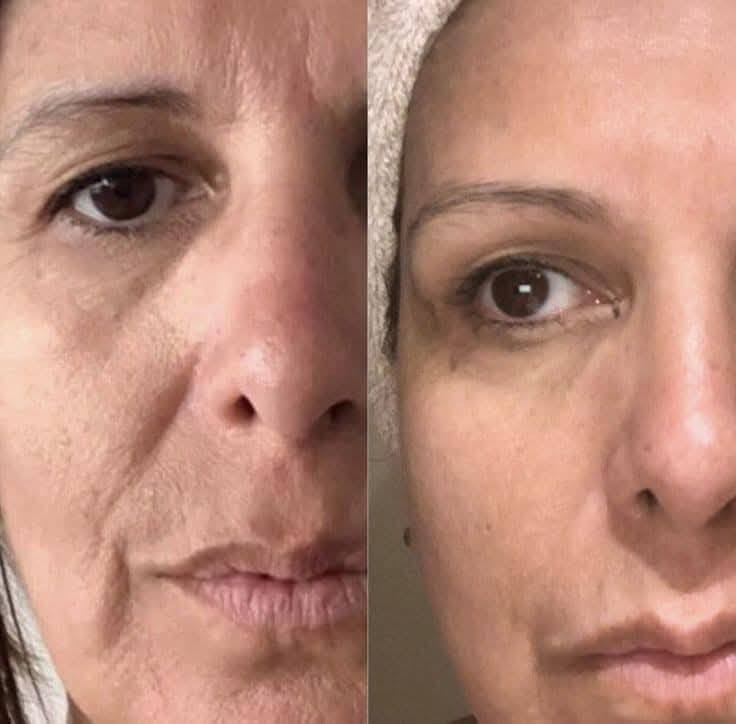 عرض ب 20  الف فقط
معالج تجاعيددد😍🤞

عرض جديد وحصري
كمية محدودة 😍🤞

والله لتجربة متخسر🤞😍


**إذا كنت صاحب هذا الإعلان وتريد حذفه لأي سبب، رجاءا أرسل رسالة إلى الدعم الفني**