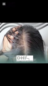 حل تساقط الشعر • كلور ومعادن • شارع الحضرة