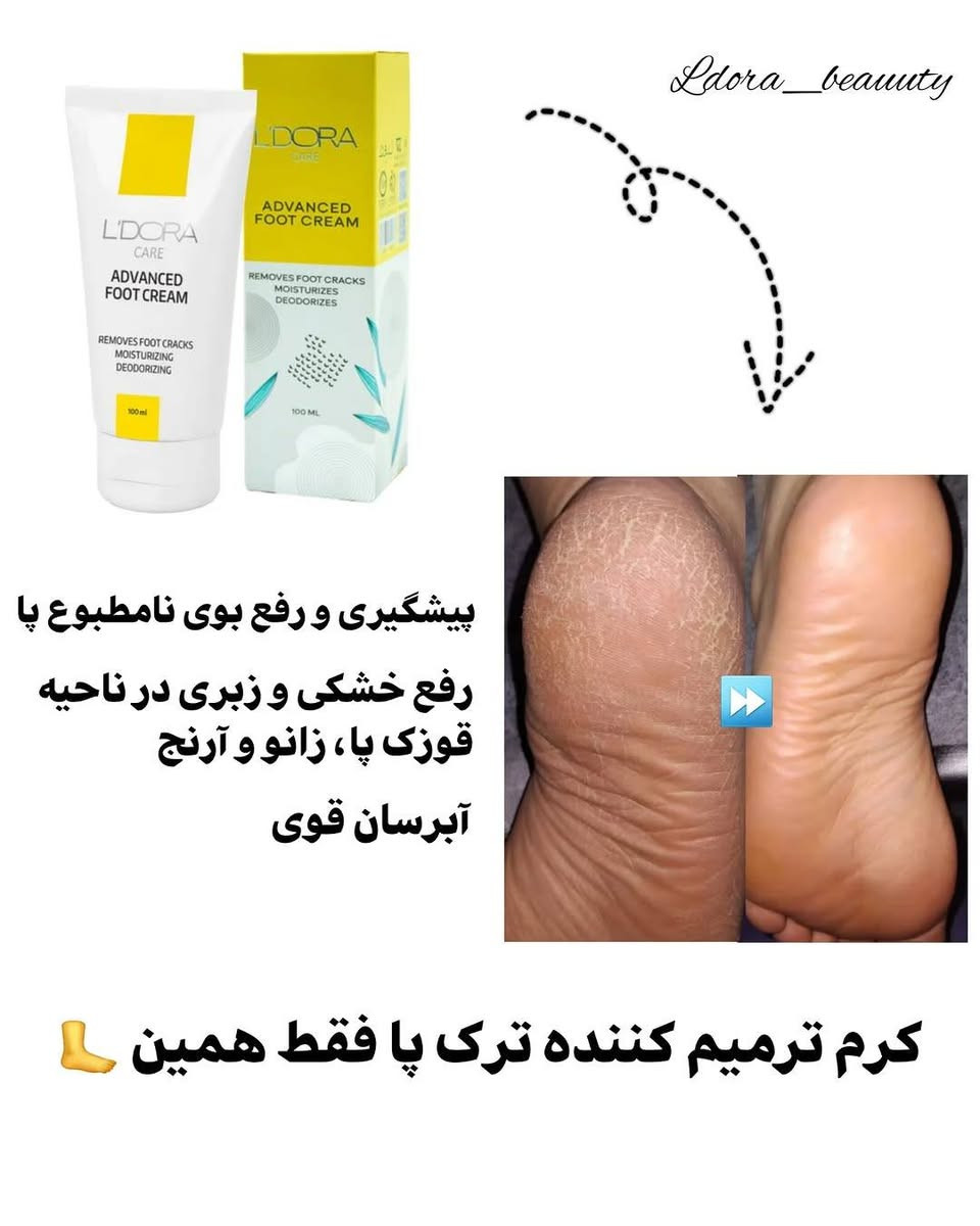 كل منتج فوائده اكثر من 5 فوائد وعالخاص نحجي عنهن ومتوفر استشاره مجانيه للحجز المراسله خاص البصرة, العراق


**إذا كنت صاحب هذا الإعلان وتريد حذفه لأي سبب، رجاءا أرسل رسالة إلى الدعم الفني**