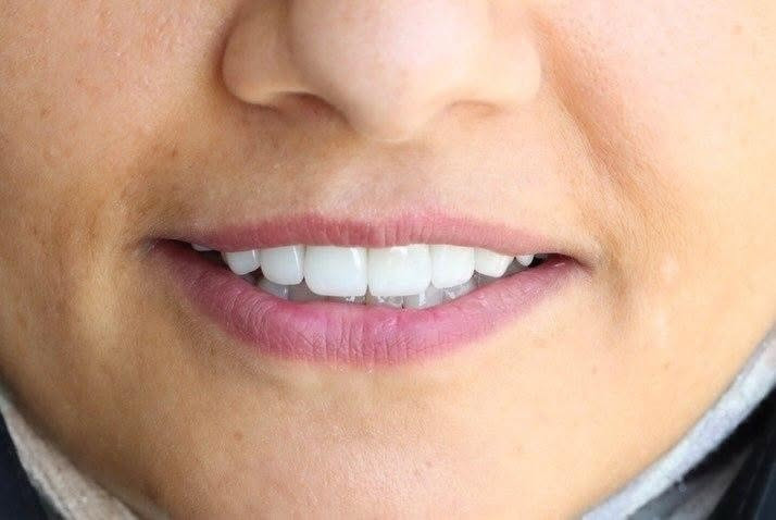 "ثقتك تبدأ بابتسامتك."

متواجدين لخدمتكم طيلة أيام الأسبوع #مراكز_الشركة_الطبية_العالمية #صحة_الأسنان #عناية_باللثة 

🔻
🏢 العنوان / بغداد _ بسماية _ الشارع العام  . مجاور ماركت الغدير 
فوق مطعم بي تاون
📲 للحجز والاستفسار 
***********
#مركز_بسماية_لطب_وتجميل_الاسنان
