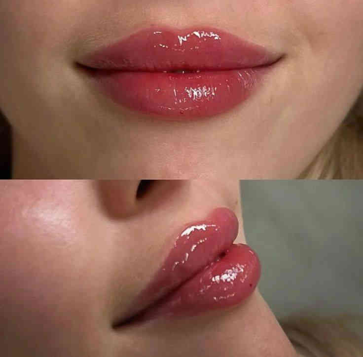 سوينه عروض 
✨تردين تسوين  تجميل ما عندج يمنه سعار مناسبا
عروض راس اسنه عروض جميلههه
*ابلازمه وجه 30💃🏻💃🏻
*ابلازمه وجه لتصبقات والكلف 40🔥🔥
*فلر شفه كوري ب30💋
*فلر شفه الفرنسي  ب35🔥💋
*فلر شفه باريسي ب50💋💃🏻
*فلر شفه اسويسري ب55💋🫂
*فلر وجنات  سيسي 35 (6جلسات)🙎🏻‍♀️
*نضاره الفائقه 45*
*ابرة العنبر الزعفرانيه ب40

*بوتوكس لرفع الحاجب  ب50🤎
*بوتوكس شد كصه ب50💆🏻‍♀️
*بوتوكس لتوسيع العين ب50🫣
*بوتوكس لشد التجاعيد 110🫢
*غمازه 25🔥🔥🔥
*تبييض البشرة ب70 ألف 💋💃🏻
*ابرة نضارة وتوريد وترطيب ب100الف 🔥🔥🔥
*علاج الگلف العميق 60 ألف 
*تعديل الأنف بل فلر ب45
*علاج داء الوردية ب30 ألف🔥🔥🔥🔥
*تغيرر شامل فلر فرنسي ايطالي 300
العنوان//كربلاء 
الستفسار /***********
