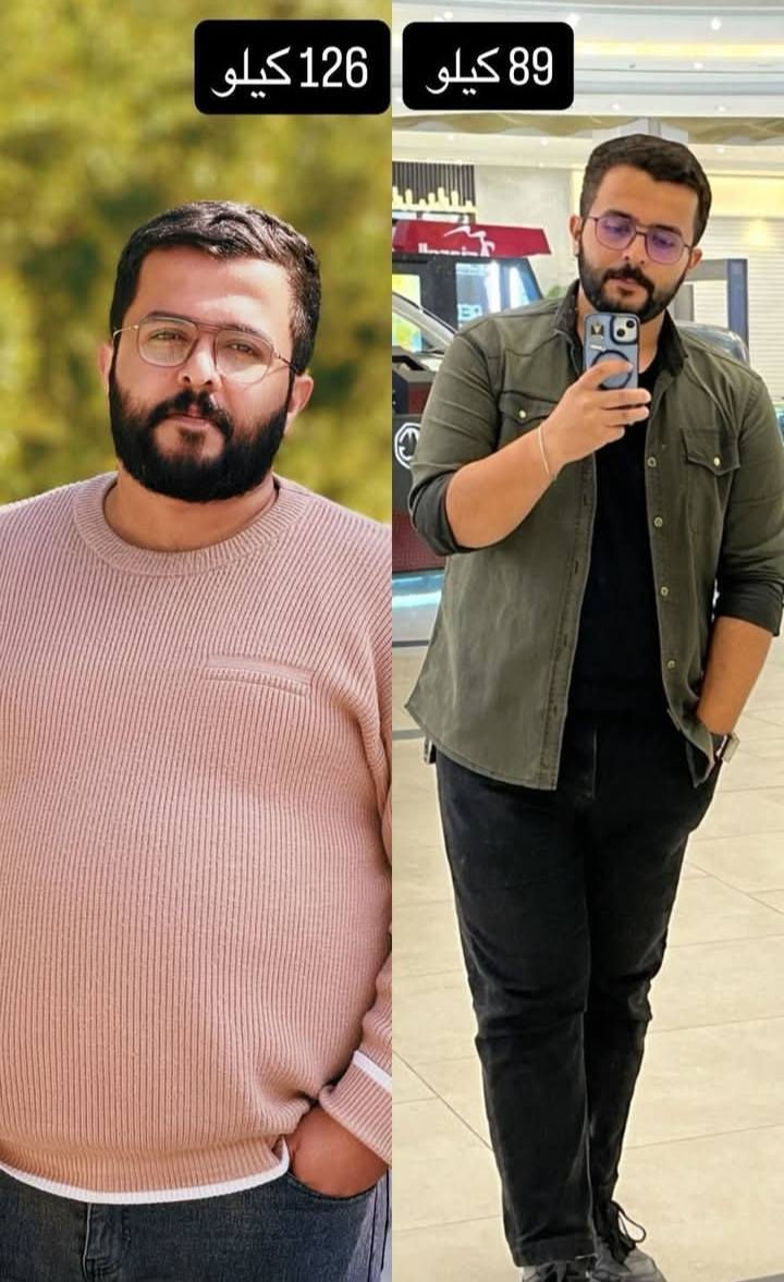 بشرى ساره لأهلنا في محافظة واسط (قضاء الصويره) والمحافظات الجنوبية والفرات الأوسط
@الجميع
مع البروفيسور الجراح
الدكتور. محمد الطائي
يتواجد الدكتور كل يوم خميس لأجراء العمليات 
والأستشاره الطبية

عملية قص المعدة 
(مليونين و٦٠٠) شاملة
عملية تحويل المسار 
( 4 مليون) شاملة
عرض لفترة محدودة 

هذا العرض يشمل :
1- مجموعة مستشفيات المؤيد. 
مستشفى المؤيد الاهلي(3) في قضاء الصويرة / شارع النجمة.

2- كافة تحاليل العملية والفحوصات التي تشمل 
(الأشعة + السونار + الأيكو +  تخطيط القلب). 

3- علاج العمليه والرقود. 
 
4- رقود لمدة يومين. 

5- عناية طبية من قبل الطبيب المقيم للبروفيسور... وتمريضية متميزة من قبل كادر متكامل. 

6- كافة مستلزمات العملية. 

7- كراس نظام غذائي علاجي مطور ما بعد العملية. 

8- متابعة فعلية مابعد العملية عن طريق كروب من قبل البروفيسور. 

9_الادوات الامريكية الجيل الثالث حصرا الاحدث في عالم عمليات السمنة. 

للحجز و الاستفسار:
***********.
***********.
إدمن محمد

#محمد_الطائي
