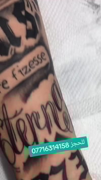 كركوك • تاتو وبيرسنك • ازالة الوشم