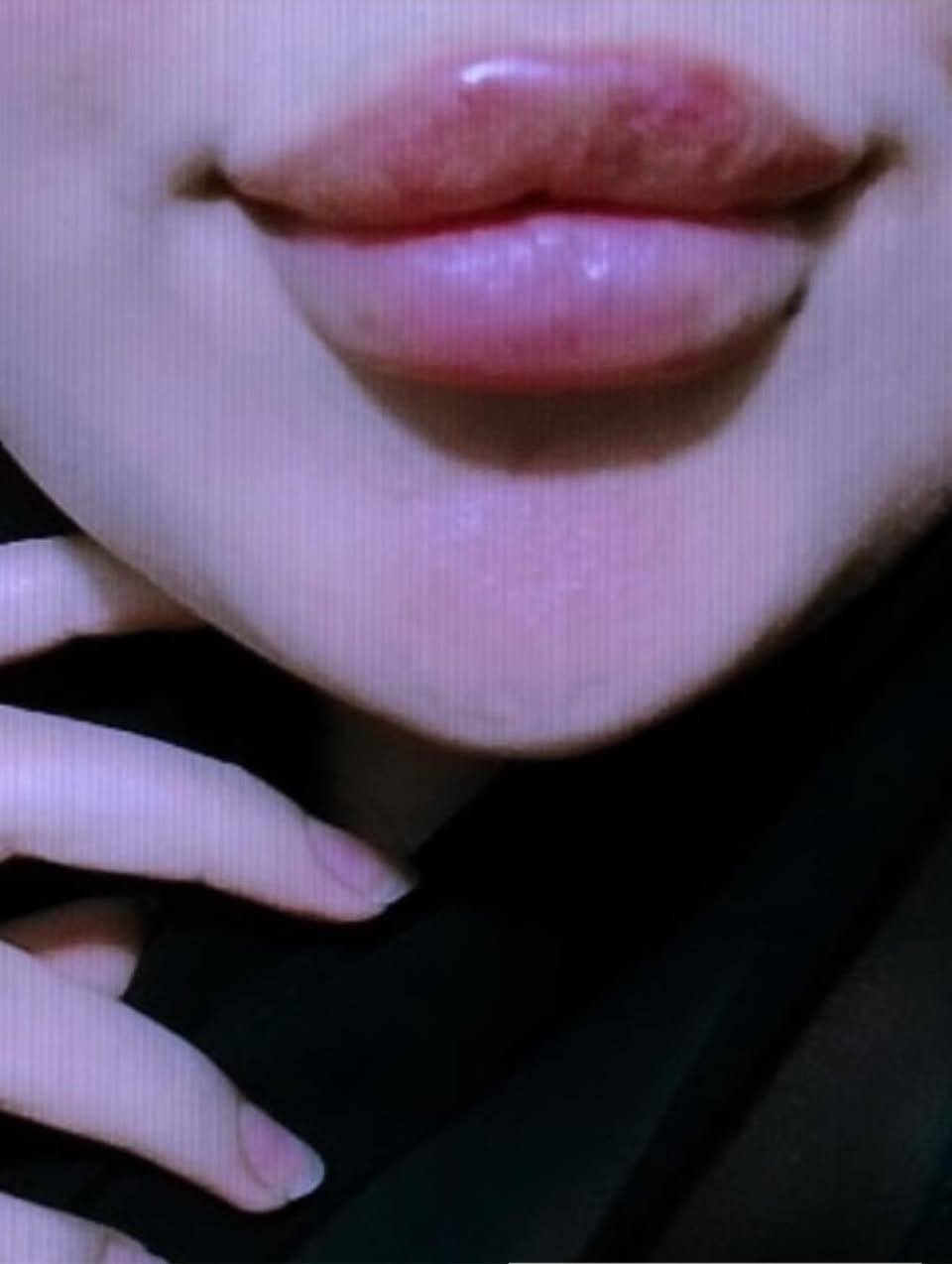 فلر شفة تعديل ع حقن سابق 🔥
من تصوير مراجعتي ✨
عرووووض شهر رمضان ثبتتهه الكم بالهايلايت بالستوري وببوست اعلى الصفحة ✨
د.ايثار سامي عبد الامير 
الكوت_الهورة_مجمع القبطان_طابق اول
الحجز***********
