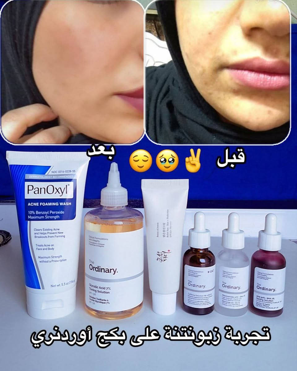 شوفولي نتائج زبونتي الحلوه ..عرض نار لحكوو وين الكون بهيج سعر
توصيل جميع المحافظات


**إذا كنت صاحب هذا الإعلان وتريد حذفه لأي سبب، رجاءا أرسل رسالة إلى الدعم الفني**