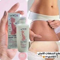 كريم • تشققات • ترطيب