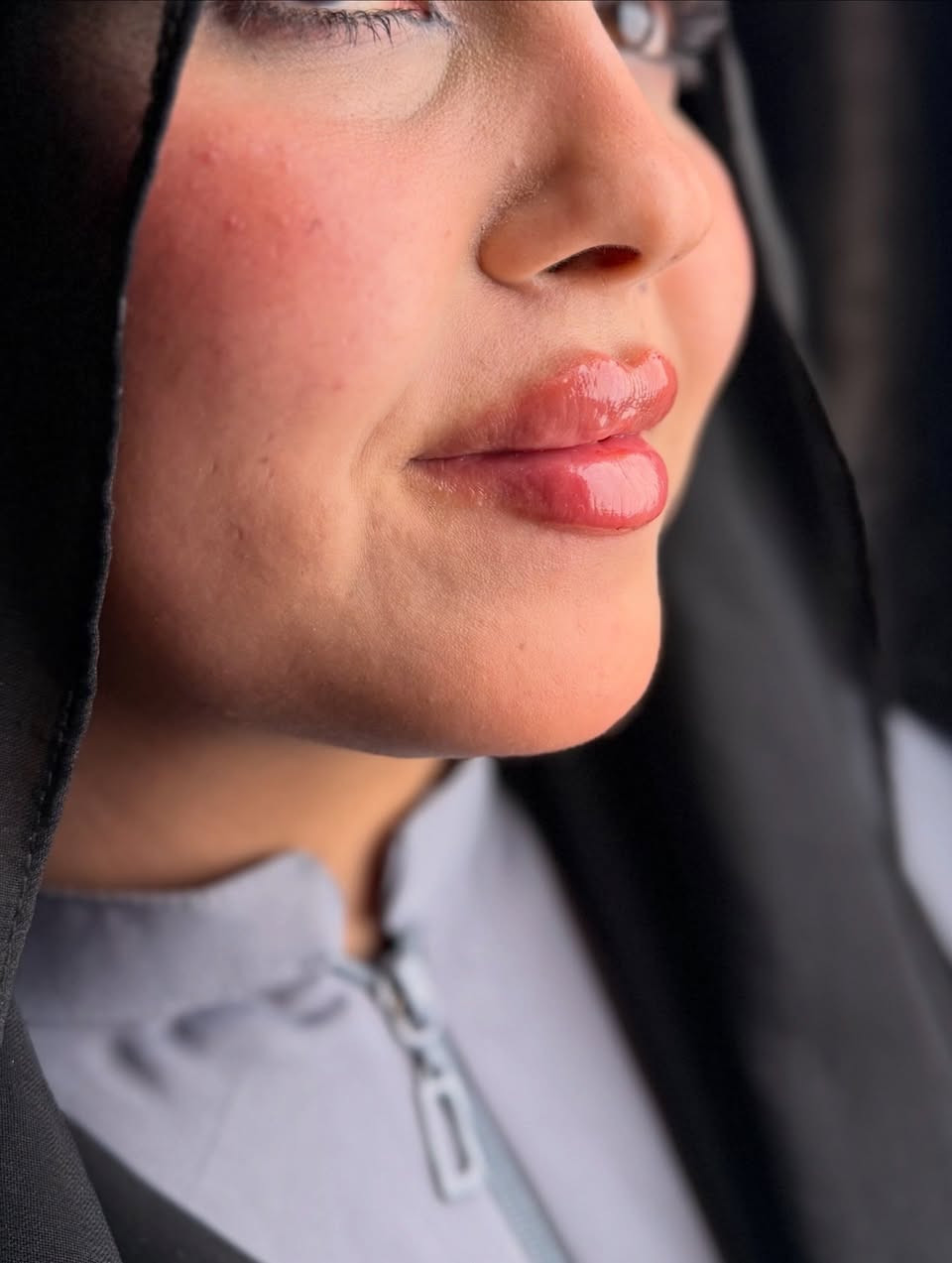 اكو احلى من هيج جمال بالحقن🙂‍↔️🔥🔥
الدكتورة ساره عدنان 💉
للحجز والاستفسار الاتصال المباشر للرقم :***********
