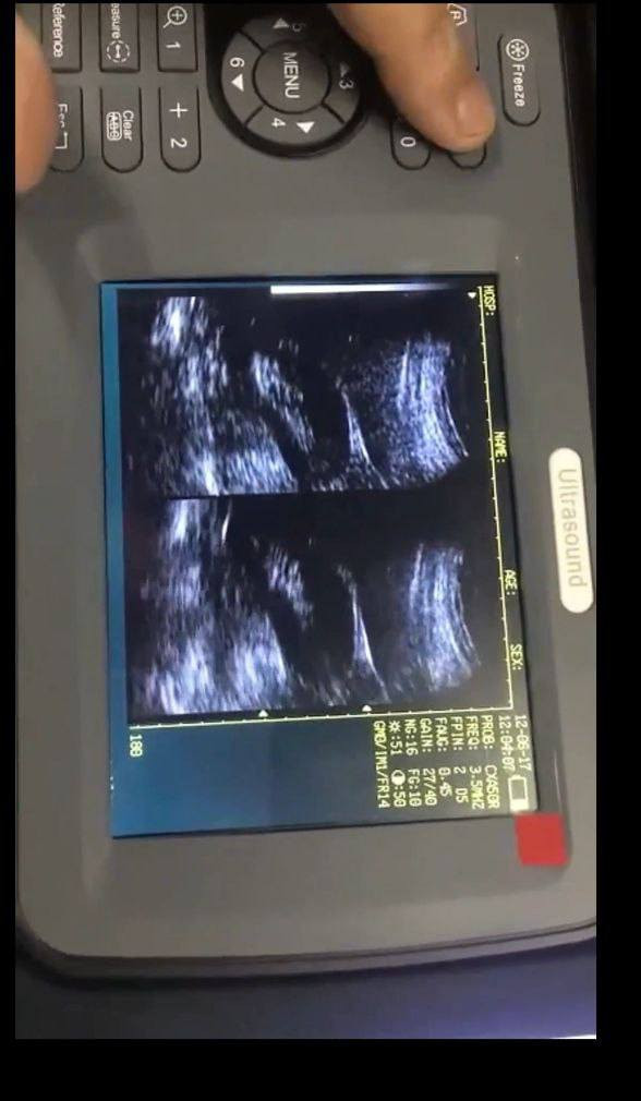 السلام عليكم متوفر جهاز تشخيص بالموجات فوق الصوتية من نوع B-Mode الموديل xF20
تيار مستمر 14 فولت التردد 50 هرتز
من  شركة ميانيانغ شيانفنغ للأجهزة الطبية البيطرية 
موديل 2014 شاشة عرض LED
يدعم حفظ الصور ونقلها عبر USB
الوزن: حوالي 1.2 كغم
يحتوي على بطارية ليثيوم ويمكن تشغيله بالكهرباء
نوع الجهاز: محمول (Handheld
السعر مناسب جدا


**إذا كنت صاحب هذا الإعلان وتريد حذفه لأي سبب، رجاءا أرسل رسالة إلى الدعم الفني**