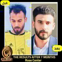 معكم الاستشارية طبيه يسر تحب تزرع لا تحتار كلينك روز اقدم وارقي مركز ب...