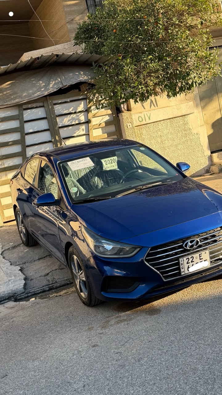 اكسنت 2020
اكسنت مديل 2020 
محرك 16 دوش 
السيارة ماشية 48miالف 
سيارة بيها قبغ صندوق مبدل وجاملغ امامي 
سيارة بدون ايرباك 
شرط التحويل باسمي
السعر 118 وبيها مجال 
***********
