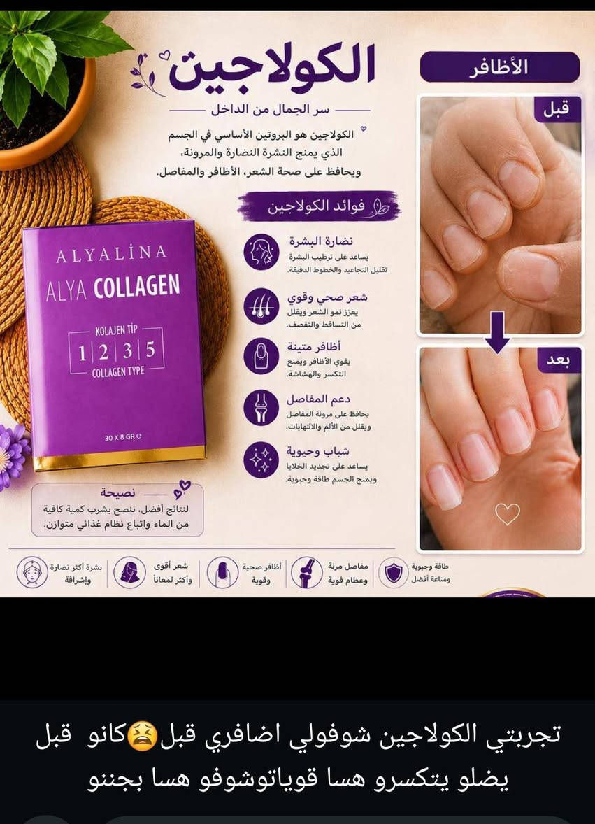 يوجد لدينا شحن للجميع مناطق العراق
في عروض الفتره محدوده 😍 أخذ ثلاثه ورابعه هديه


**إذا كنت صاحب هذا الإعلان وتريد حذفه لأي سبب، رجاءا أرسل رسالة إلى الدعم الفني**
