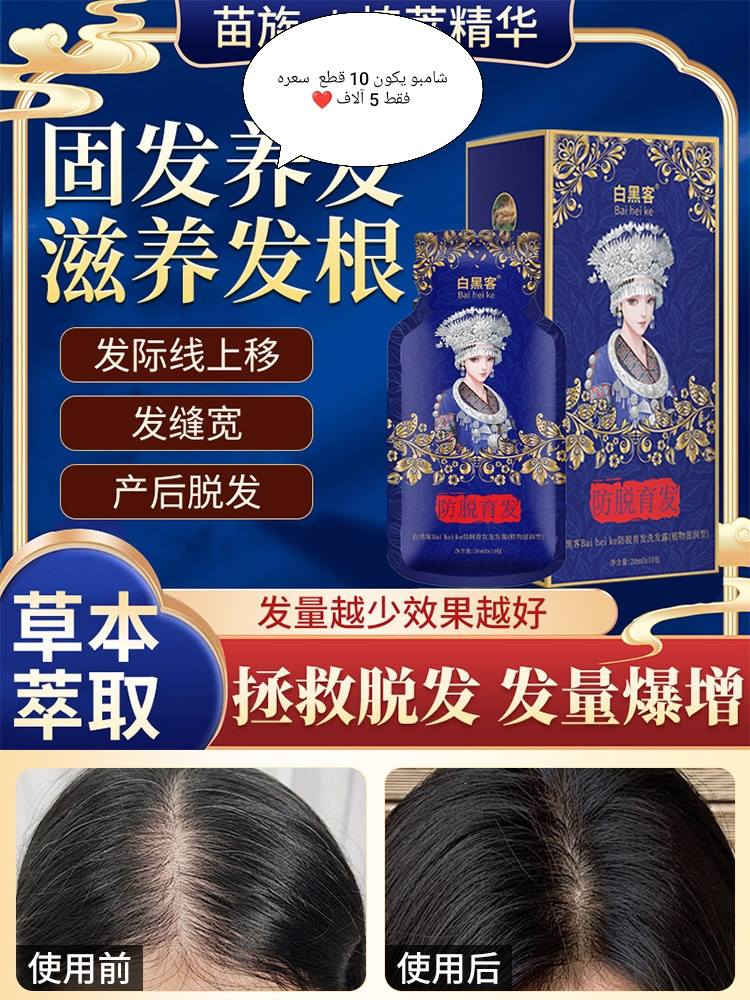 سلام عليكم
عندي عنايه بشره منتجات من كوريا ماركات عالميه اسعار مناسبه ✨
يوجد عندنا خدمه توصيل كافه محافظات العراق 5 آلاف توصيل اي قطعه تعجبج مراسله الصفحه 🥰


**إذا كنت صاحب هذا الإعلان وتريد حذفه لأي سبب، رجاءا أرسل رسالة إلى الدعم الفني**