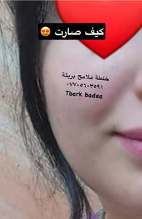خدود • تسمين • تبييض