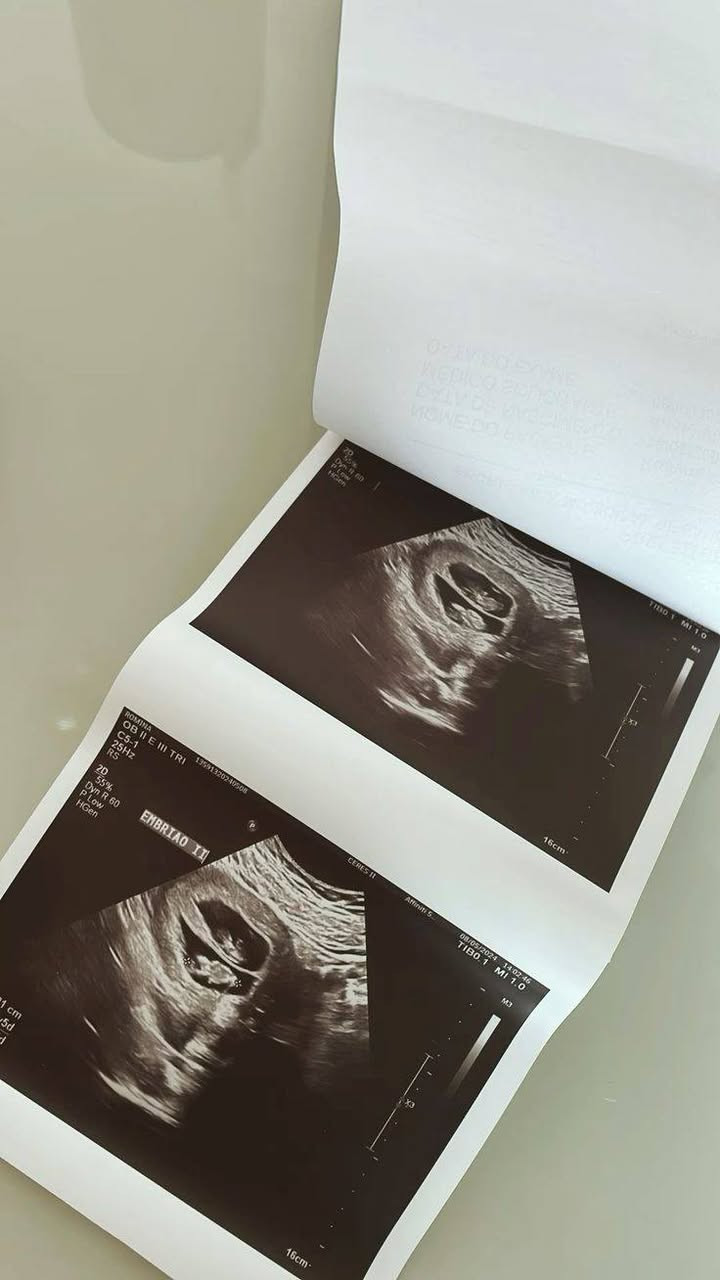 الدكتورة
                 #خنساء_حميد_الدليمي
طبيبة اختصاص بورد(دكتوراة ) جراحة الأمراض النسائية والتوليد
#ماجستير_في_معالجة_العقم
معالجة مشاكل العقم المعقده والممتده لسنوات عديدة
#الفحص_بجهاز_السونار_الحديث_والدوبلر
#مجمع الرازي الطبي ابوغريب الحصوه
مجاور صيدلية غفران عامر سامي
للحجز والاستفسار ***********_***********
