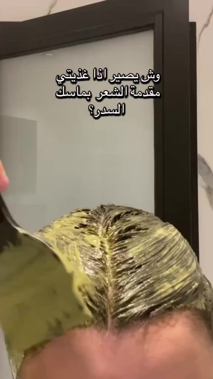 بكج العنايه باالشعر الي متكون من👇🏻
الحناء و السدر 🌿🌿
🌿 فوائد الحناء للشعر لا تُعد ولا تُحصى 🌿
هل تعانين من تساقط الشعر؟ أو تبحثين عن 
حل طبيعي لزيادة كثافة ونعومة شعرك؟
إليك السر القديم الجديد: الحناء والسدر🌿

✨ فوائد الحناء للشعر:
 تقلل من تساقط الشعر بشكل ملحوظ🌿
 تساعد في زيادة كثافة الشعر🌿
 تمنح الشعر لمعان طبيعي ونعومة فائقة🌿
 تعزز صحة فروة الرأس وتقلل من القشرة🌿
 خالية تماماً من المواد الكيميائية الضارة🌿

فوائد السدرللشعر 

:للشعر:🌿
- تقوية الشعر ومنع #التساقط.
- تنظيف فروة الرأس والتخلص من القشرة.
- ترطيب الشعر الجاف وإصلاح الشعر التالف.
- تحفيز نمو الشعر.

استخدمي الحناء والسدر🌿
مرة أسبوعيًا
 وراقبي الفرق بنفسك

سعر البكج: 15


**إذا كنت صاحب هذا الإعلان وتريد حذفه لأي سبب، رجاءا أرسل رسالة إلى الدعم الفني**