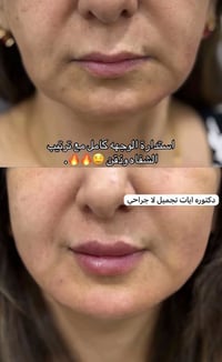 دكتوره ايات. سنتر رزان العنوان  جسر ديالى شارع 60 قرب معهد الزهراء الن...