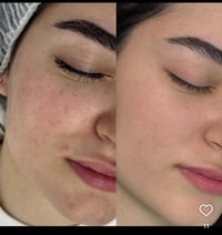 البشرة يمنا تصير گلوي   العنوان :  بغداد الجديدة الشارع العام مقابيل ا...