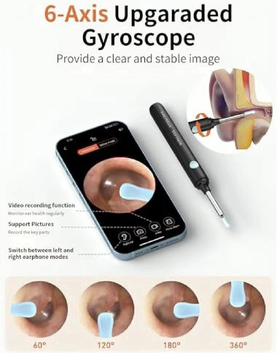 منظار الأذن لإزالة شمع الأذن

Earwax Remover Otoscope, Hopefox 5MP HD Wifi Ear Cleaner tpvz

5.OMP WiFi earwax remover: wireless otoscope, don't worry about the cable problem. The WiFi is built inside the small body. 5.0MP lens full HD resolution can provide superior clear image, equipped with silicone ear spoon to make you and children more comfortable and safe in use.

IP67 Waterproof Lens: The lens of our ear endoscope camera has the waterproof protection grade IP67. In daily cleaning, it can be washed with water or wiped with alcohol. Note: only the lens is waterproof, the body machine is not.

Multi-purpose and wide compatibility: the otoscope has a wide range of applications, the wifi ear cleaner otoscope can not only be used to remove earwax, but also to observe other body parts such as nose or throat. Otoscope camera is suitable for adults, children and pets. Perfectly compatible with iOS and Android smartphones or tablets (except Windows)
USB-C Fast Charging The battery capacity of the otoscope ear cleaner is 240mAh, equipped with Type-C charging interface, which can work continuously for about 50 minutes or for about 60 days in standby mode. 
Note: when using for the first time, we recommend fully charging the otoscope before using


**إذا كنت صاحب هذا الإعلان وتريد حذفه لأي سبب، رجاءا أرسل رسالة إلى الدعم الفني**