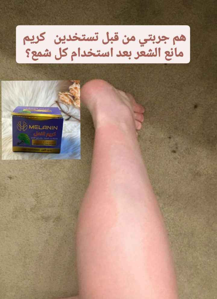 كريم النمل Melanin Ants Cream

 وهو منتج تجميلي يستخدم بشكل أساسي لتقليل نمو الشعر غير المرغوب فيه في الجسم، ويُسوق له كبديل طبيعي لليزر

الفوائد الرئيسية للمنتج
تقليل نمو الشعر يعمل على إضعاف بصيلات الشعر تدريجياً مما يقلل من كثافته وسرعة نموه مع الاستخدام المنتظم

بديل لليزر يساعد في الحصول على بشرة ناعمة وخالية من الشعر لفترات أطول دون الحاجة لجلسات الليزر المكلفة

ترطيب البشرة يحتوي على خلاصة زيت السعد التي تساهم في ترطيب البشرة وتخفيف الجفاف والتهيج الناتج عن عملية إزالة الشعر

نضارة البشرة: يزيد من حيوية وإشراق البشرة ويجعل ملمسها ناعماً 

يعتمد الكريم على تركيبات طبيعية، وأبرزها
خلاصة زيت السعد Cyperus oil المعروف علمياً بقدرته الفعالة على تأخير نمو الشعر
زيت النمل وهو مادة تقليدية تستخدم لتقليل كثافة بغداد, العراق


**إذا كنت صاحب هذا الإعلان وتريد حذفه لأي سبب، رجاءا أرسل رسالة إلى الدعم الفني**