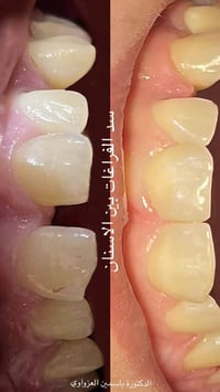 عيادة الماسة • طب الاسنان • جويبة