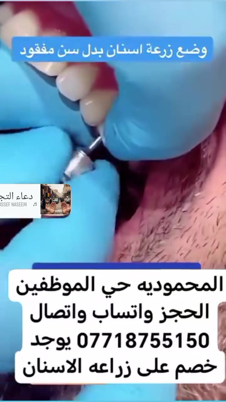 🔥 عرض خاص خلال هذا الأسبوع فقط! 🔥 عيادة الدكتور احمد الجنابي لطب وتجميل الاسنان 
إذا كنت تفكر بزراعة الأسنان، فهذا هو الوقت المناسب.
✅ أفضل أنواع زراعة الأسنان ✅ أسعار مميزة من الأرخص في المنطقة ✅ نتائج طبيعية وثابتة ✅ يتوفر نظام التقسيط لتسهيل العلاج
لا تؤجل ابتسامتك… احجز موعدك الآن واستفد من العرض قبل انتهاء الأسبوع.


**إذا كنت صاحب هذا الإعلان وتريد حذفه لأي سبب، رجاءا أرسل رسالة إلى الدعم الفني**