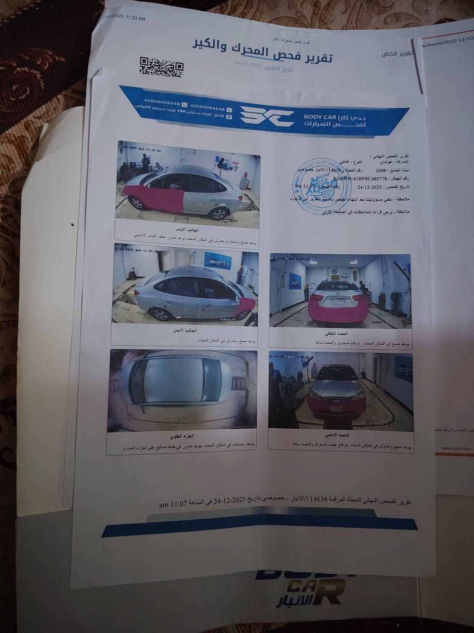 سلام عليكم افانتي  2008البيع  السعر  97وبيه مجال   تحويل  مباشر  وهاذ السونار سيارة  لاتبديل  ولا داخل   سيارة حلوه  مكان سيارة  فلوجه  ***********تواصل عل خط  فقط
