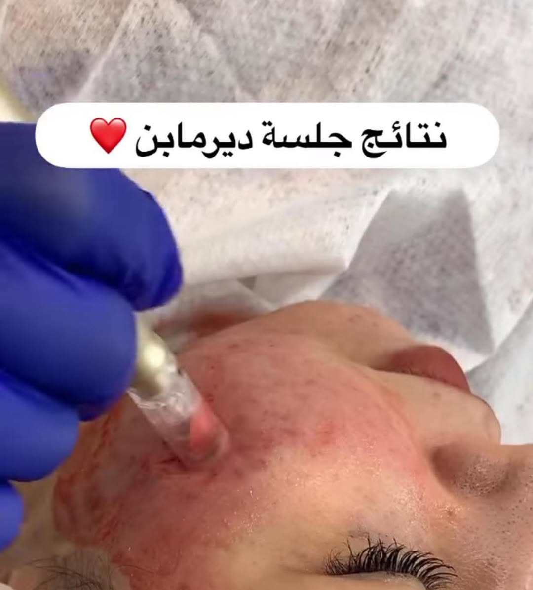 العنوان حي القاهرة مقابل ماركت الباشا
@الرقم ***********

الحجز والاستفسار
