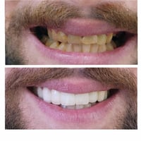 😂 لما تشوف صورتك القديمة وتندم: "ليش ما رحت للدكتور من زمان؟!" ✨ والنت...