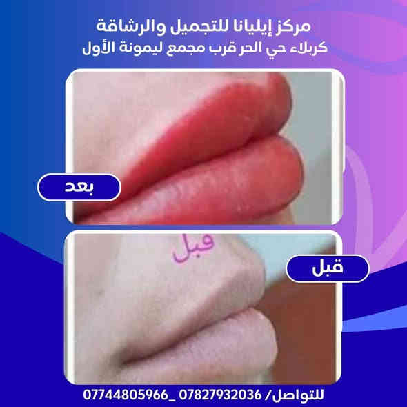 #عروض_تهز_الكاع
🎄بمناسبة رأس السنة🎄
🎇🎈🧨🎁🎆🎇✨
سويتلكم عرض يجنن لمدة اسبوع 
اوقات الدوام من الساعه 10صباحا لغايه 8 ليلا 
الافضل الحجز قبل الحضور 

1_ قص شعر 10الاف 
2 _قص +تريتمنت معالج مرمم 15 الاف 
3_حف الوجه ب الخيط 10لاف 
4_ واكس للوجه + خيط ب15 الف
5_ تنضيف بشره بجهاز البخار حار وبارد وإزالة الرؤوس السوداء
والدهون 20 الف
5_تنضيف عادي 10الف
نجي للشعر 
1 _تجذير للشعر فقط 15 الاف 
2_ صبغ شعر القصير 25 
3_ صبغ شعر وسط 30
4_ صبغ للشعر الطويل 40 
5_ ميش كذله وزلف فقط 20 
6 _ميش للشعر القصير 35 
7_ ميش للشعر المتوسط 45
8_ ميش للشعر الطويل 65
📌 العنوان
💒كربلاء حي الحر قرب مجمع ليمونة الأول
💇#مركز_ايليانا_للحلاقة_والتجميل
للحجز والاتصال
📲***********
☎️***********
