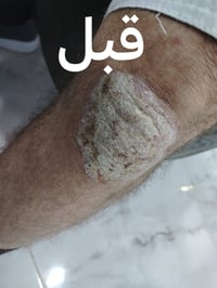 دكتور خلدون • صدفية • ناحية الشورة