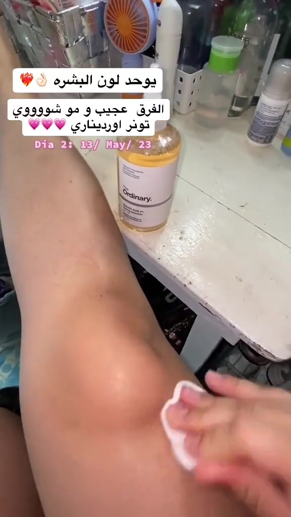 💘🥺عرض خاص تحطيم الاسعار😉
تونر الاوردنري ➕هدية قطن مكياج 🥀
تونر اوردنري  جلايكولك اسد
‏Glycolic acid 7% Toning' The Ordinary تونر يحتوى على جليكوليك اسيد من أهم أحماض المغذية للبشرة

يعمل على: 
تقشير البشرة برقة شديدة ولطف وبشكل غير ملحوظ إزالة الجلد الميت 
تحسين مظهر الخطوط والتجاعيد 
وتحفيز الكولاجين محاربة الحبوب فوق الجلد وتحت الجلد بشكل فعال 
تفتيح و توحيد لون البشرة تصغير حجم المسام
طريقة الاستخدام 
مرة واحدة يوميا مساءا على بشرة نظيفة باستخدام قطنة نظيفة وتمريرها على البشرة ،،تجنبي منطقة العين
غير مناسب للبشرة الحساسه المتهيجه
حجم كبير 240 مل
الاصلي امريكي

Beutyful❤️
لأزالة المكياج من الوجه 🎃🎃
تستخدمي ويه الريموڤر مزيل المكياج ☔️
ملمسه ناعم جداً ع بشرتج ✔️✔️


**إذا كنت صاحب هذا الإعلان وتريد حذفه لأي سبب، رجاءا أرسل رسالة إلى الدعم الفني**