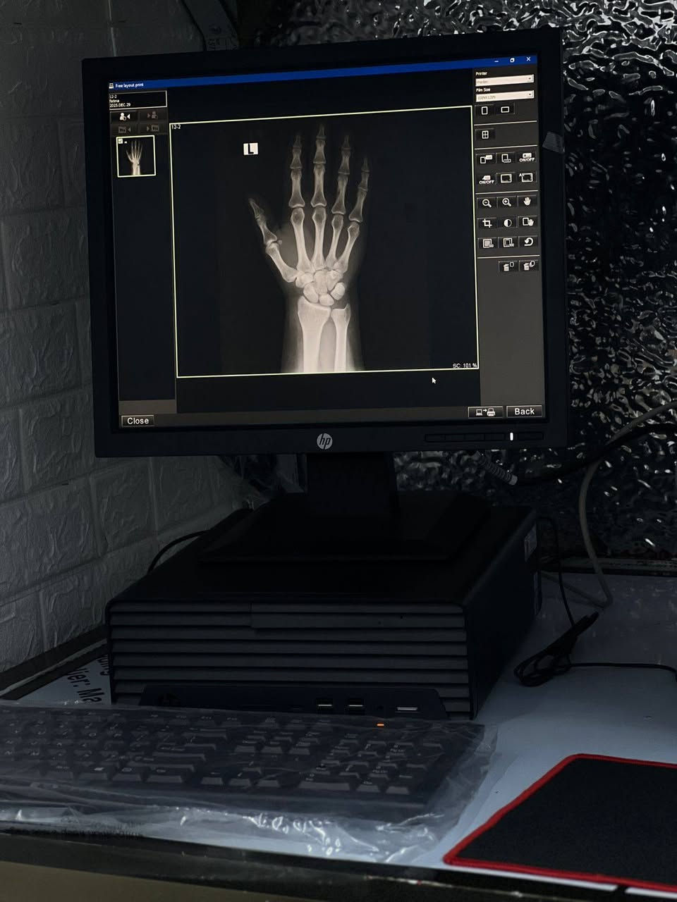 يعلن مجمع الجوهرة الطبي عن توفر الخدمات التالية:
🩻 عيادة الأشعة
• مجهزة بأحدث الأجهزة الطبية
• بإشراف أخصائية الأشعة رانية حمّاد
• متوفرة طيلة أيام الأسبوع ما عدا الخميس
❤️ خدمة تخطيط القلب (ECG)
🩹 خدمة الضماد والتداوي
⏰ أوقات الدوام:
من 3:00 عصراً حتى 8:00 مساءً
📍 العنوان:
الرضوانية – القطاع الزراعي
📞 للاستفسار:
***********
