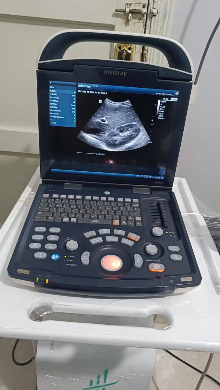 🔥 فرصة مميزة لامتلاك جهاز Mindray DP20 بحالة ممتازة
✅ دوبلر على البروبين
✅ بروب كونفكس + بروب فاجينال
✅ بطارية داخلية لسهولة العمل والتنقل
✅ صورة عالية الجودة وأداء موثوق

الجهاز جاهز للشغل والمعاينة في أي وقت
 لتواصل خاص او واتساب

📞 01114878515
📞 01035163941


**إذا كنت صاحب هذا الإعلان وتريد حذفه لأي سبب، رجاءا أرسل رسالة إلى الدعم الفني**