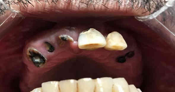 العنده هيج حالات ويحتاج حشوات تجميليه او قلع او تعويض لاسنانه يراسلني العلاج مجاني
يراسلني واتساب ***********
