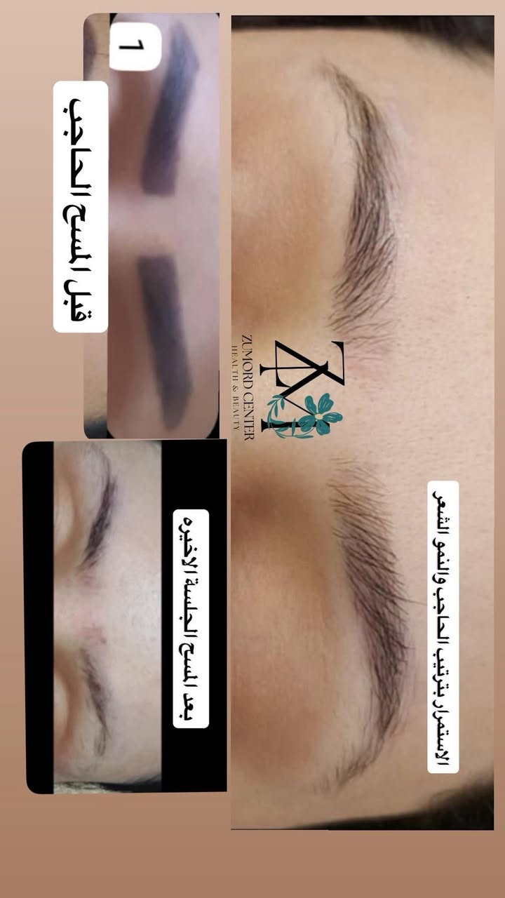 بقدوم شهر محرم الحرام حبينا نسوي الكم عرض على اكثر شي دتسألون عنه 
الي هو ازالة التاتو والتخلص منه نهائياً 
سعر الجلسة الاولى حتكون الكم ب15 الف فقط 
حتى تجربون الشغل وتشوفون شلون تحصلون نتيجة حلوة من اول جلسة 😍🦋
والي تحجز 3 جلسات سويه تكون الها جلسة رابعة مجاناً 
ماعليكم الا تتواصلون على رقم السنتر وتحصلون حجز 

‭***********‬
العنوان/ حي الموظفين مجمع مزايا الامل الطبي الطابق الثاني فوق صيدلية مزايا الامل 
شاركو المنشور بالگروبات حتى الكل يستفاد والي تشارك اكثر تحصل جلسة مجاناً♥️

